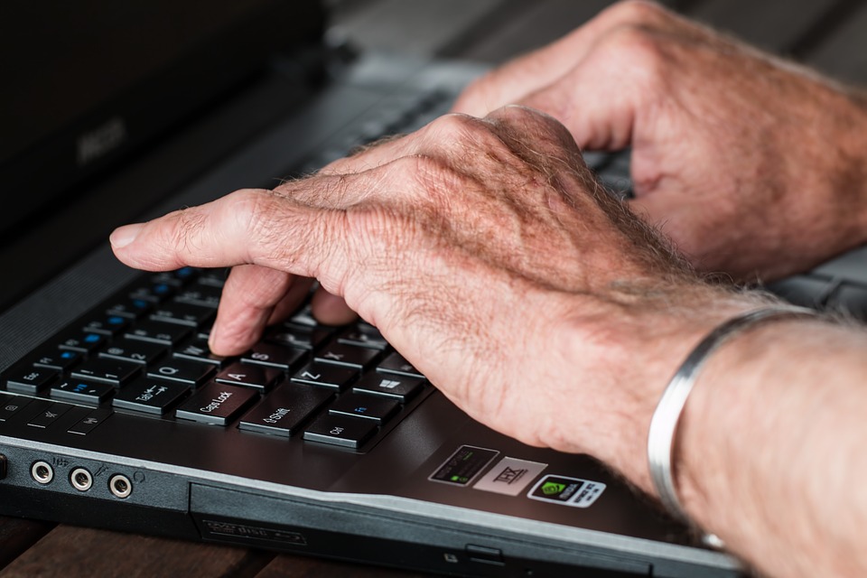 Aging hands that have no arthritis.